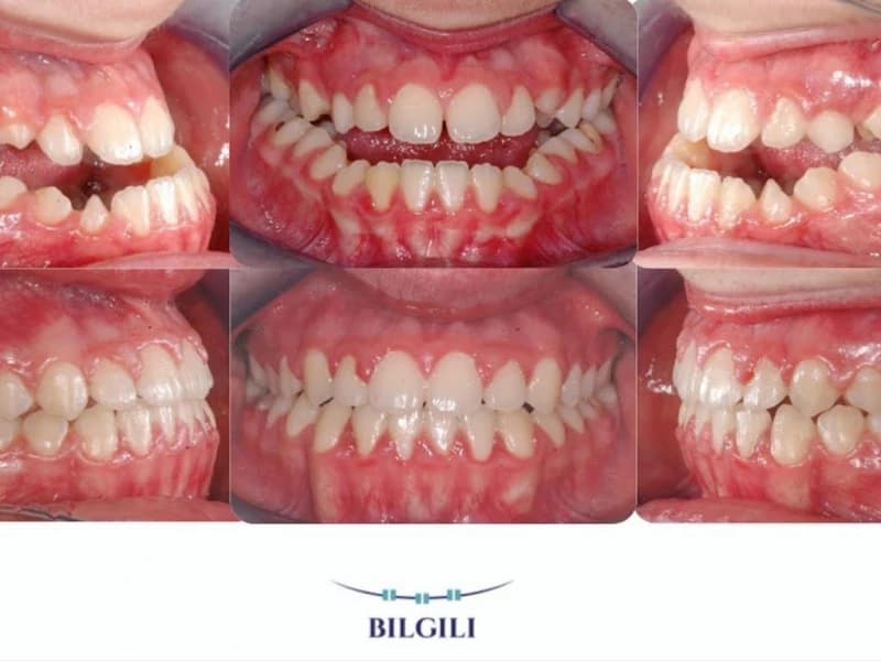 ARTI ORTODONTİ ESTETİK AĞIZ VE DİŞ SAĞLIĞI POLİKLİNİĞİ - Facility Photo