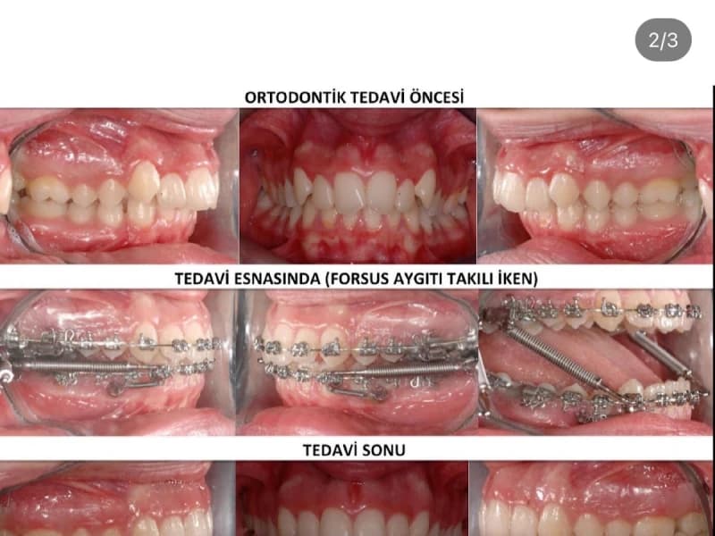 ARTI ORTODONTİ ESTETİK AĞIZ VE DİŞ SAĞLIĞI POLİKLİNİĞİ - Facility Photo