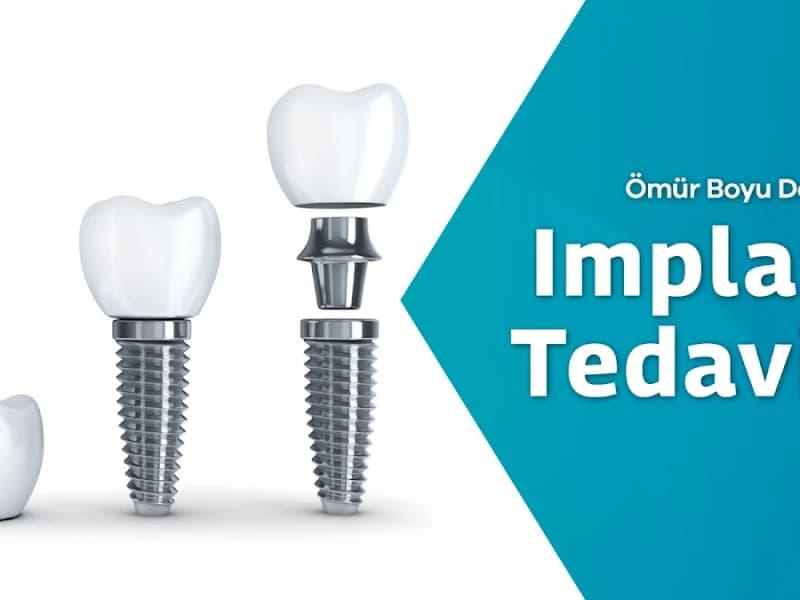 Alldent Oral and Dental Health Polyclinic Bahçelievler - Facility Photo