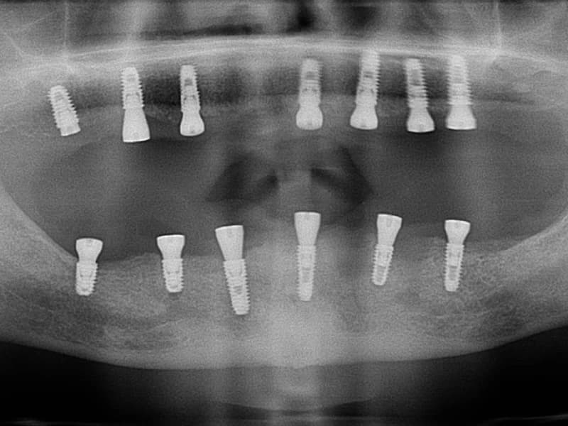 Optimum ağız and diş sağlığı polikliniği - Facility Photo