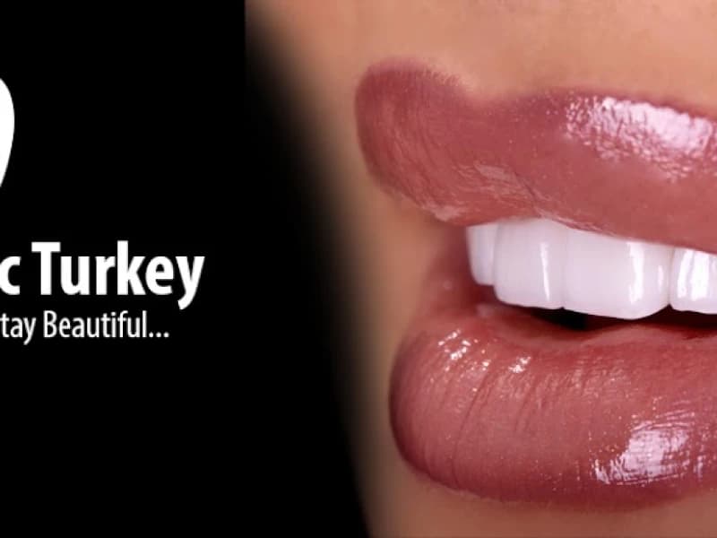 Dental Clinic Antalya - Facility Photo