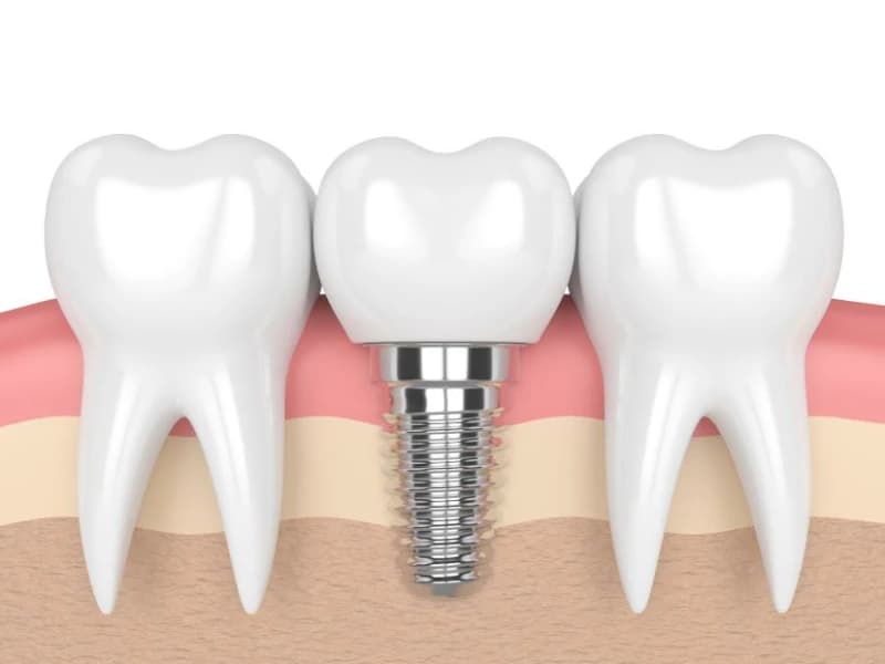 Aile Diş Oral and Dental Health Polyclinic - Facility Photo