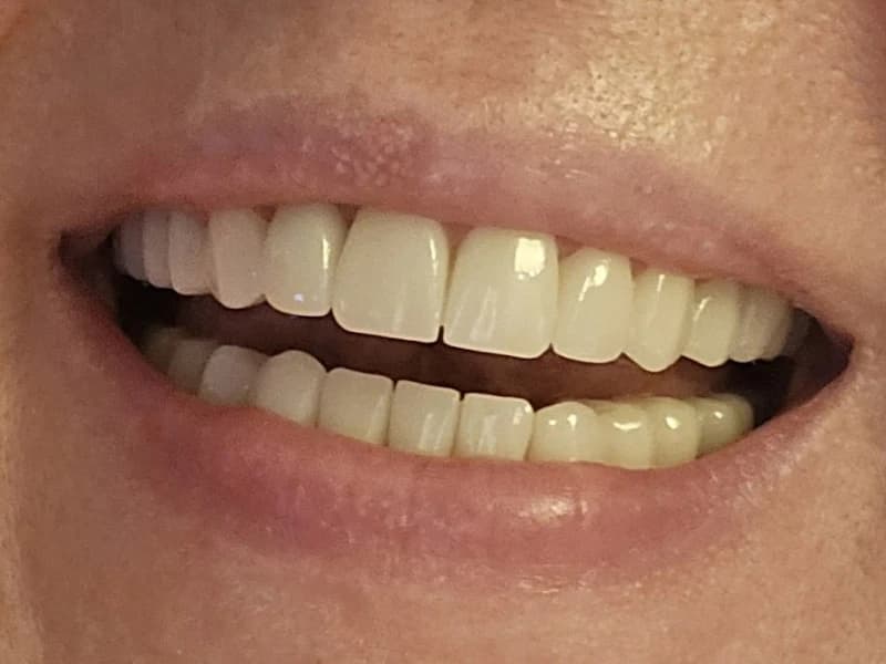 DentaPoint International - Alsancak Şubesi Zirkonyum , Diş İmplantı , Aesthetic Diş Tedavileri , Çocuk Diş - Facility Photo